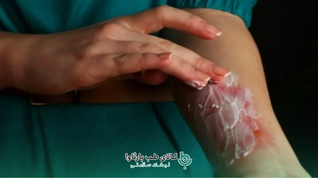 استفاده از خمیر دندان برای درمان زخم