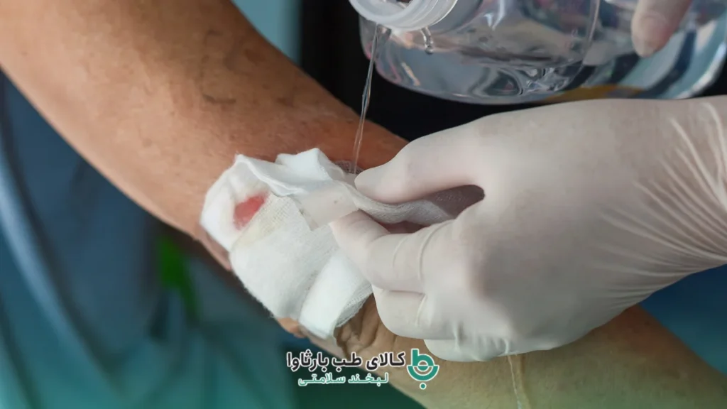 شستشوی زخم به شکل نوین